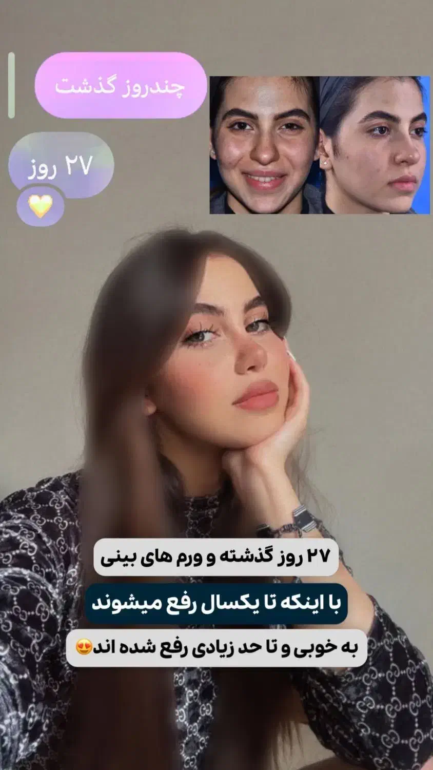 اف زیبایی بینی و لیپو|خدمات آرایشگری و زیبایی|اهواز, کیانپارس |دیوار