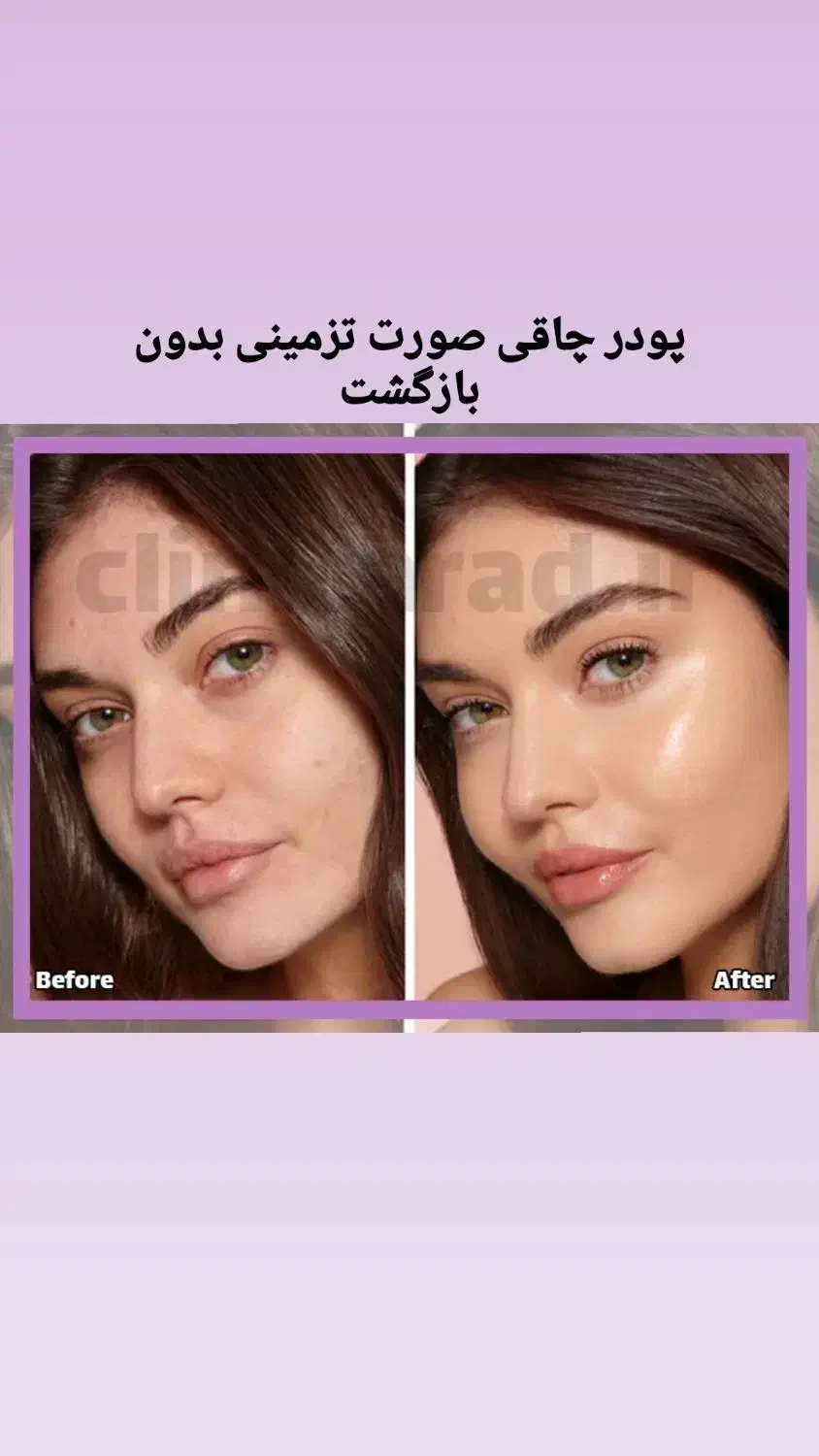 پودر چاقی صورت|آرایشی، بهداشتی، درمانی|مشهد, محمدآباد|دیوار