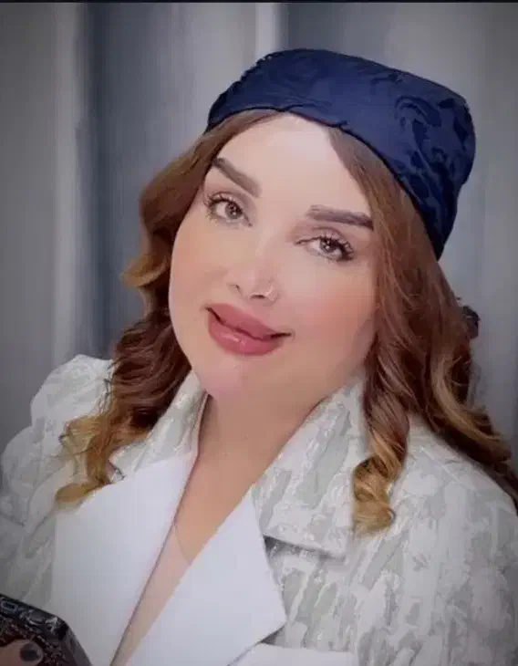 ورکشاپ اموزشی ژل وبوتاکس فقط ۵ت|خدمات آموزشی|فولادشهر, B2|دیوار