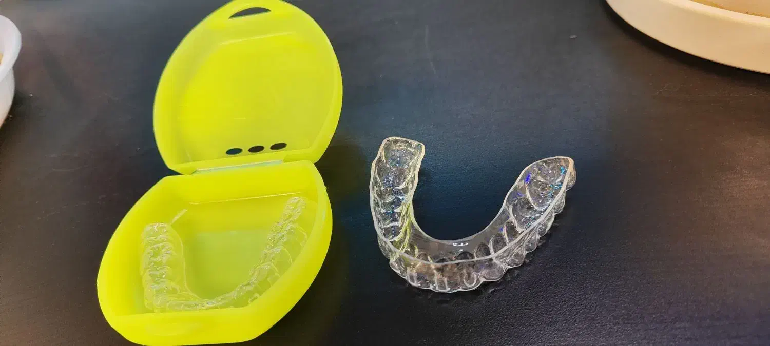 ارتودنسی شفاف الاینر|پزشکی|تهران, آسمان|دیوار