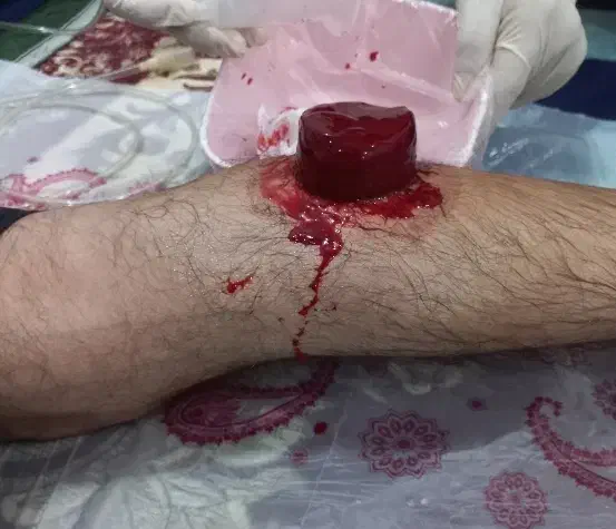 حجامت وبادکش گرم آقا وخانم|خدمات آرایشگری و زیبایی|بندرعباس, |دیوار