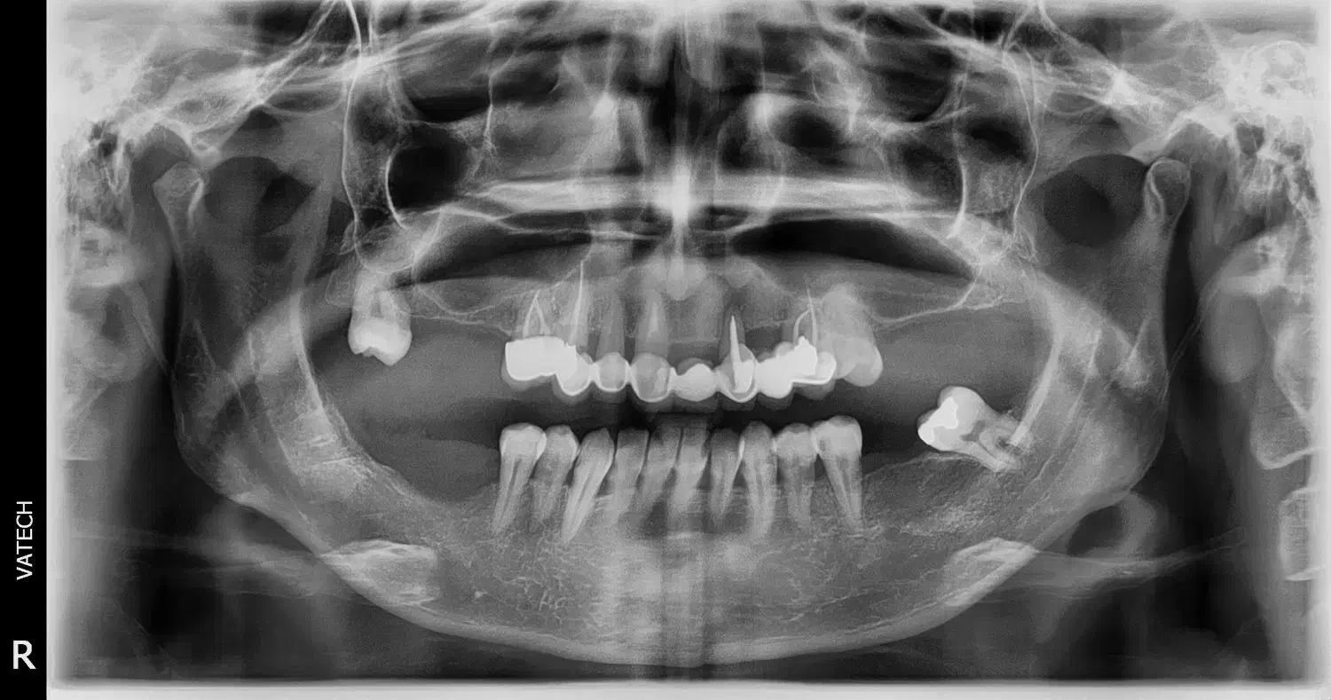 اسلاگ ساچمه پی سی پی تیر تفنگ بادی pcp|کوهنوردی و کمپینگ|سنندج, |دیوار