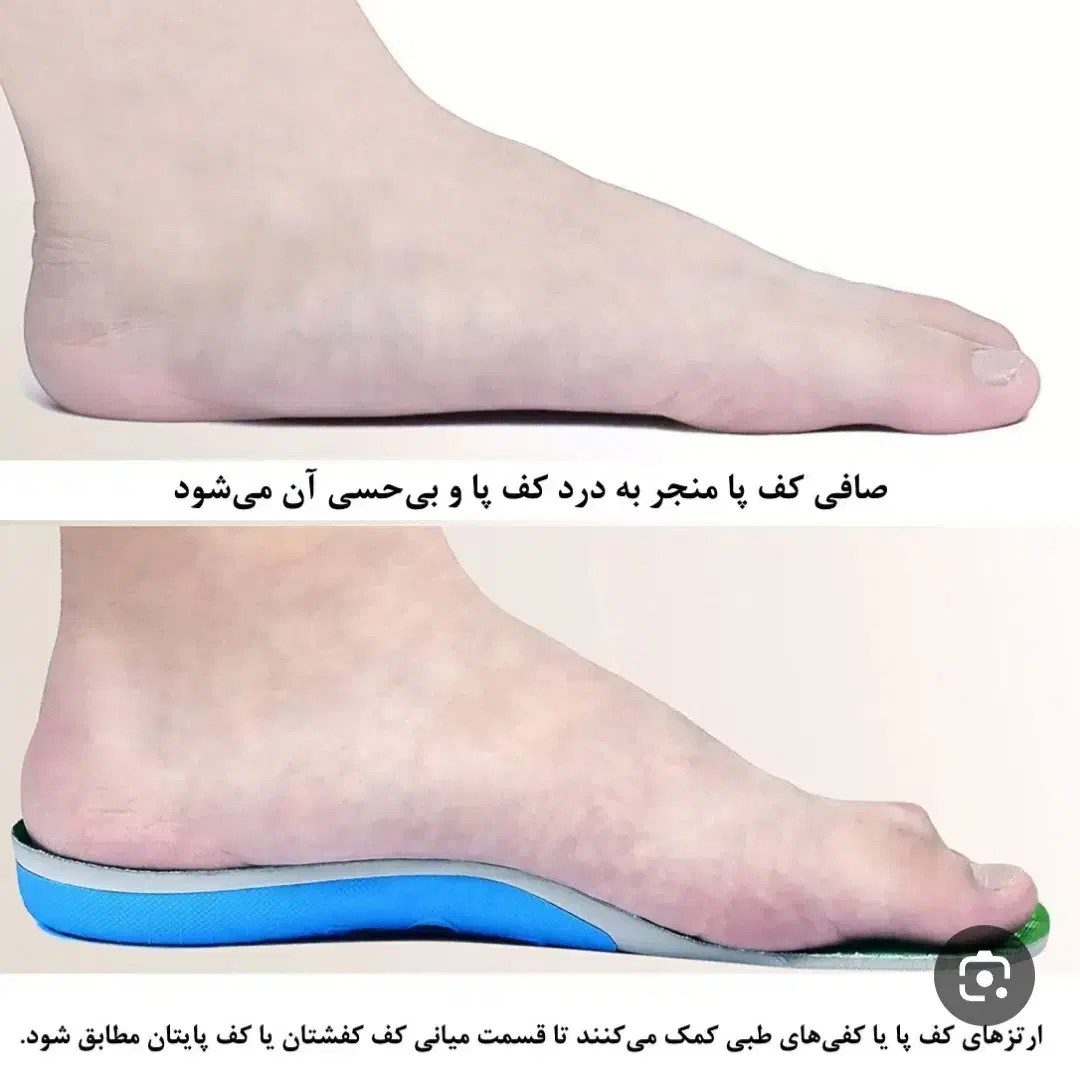 کلینیک درمان صافی کف پا|خدمات آرایشگری و زیبایی|همدان, |دیوار