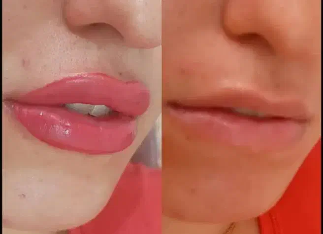 مدل میخوام جهت تاتو و پاک کردن تاتو(زیر نظر استاد)|خدمات آرایشگری و زیبایی|کاشان, دشت چال|دیوار