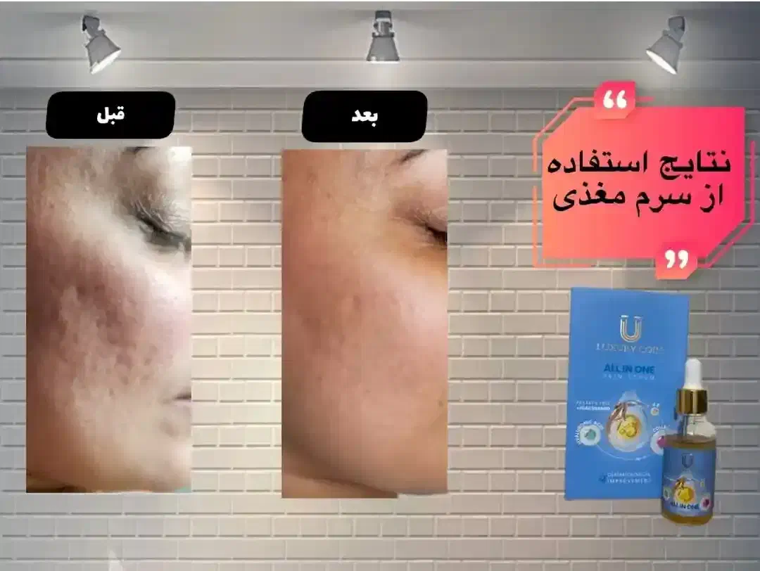 اکسیرجوانی|آرایشی، بهداشتی، درمانی|تالش, هشتپر|دیوار