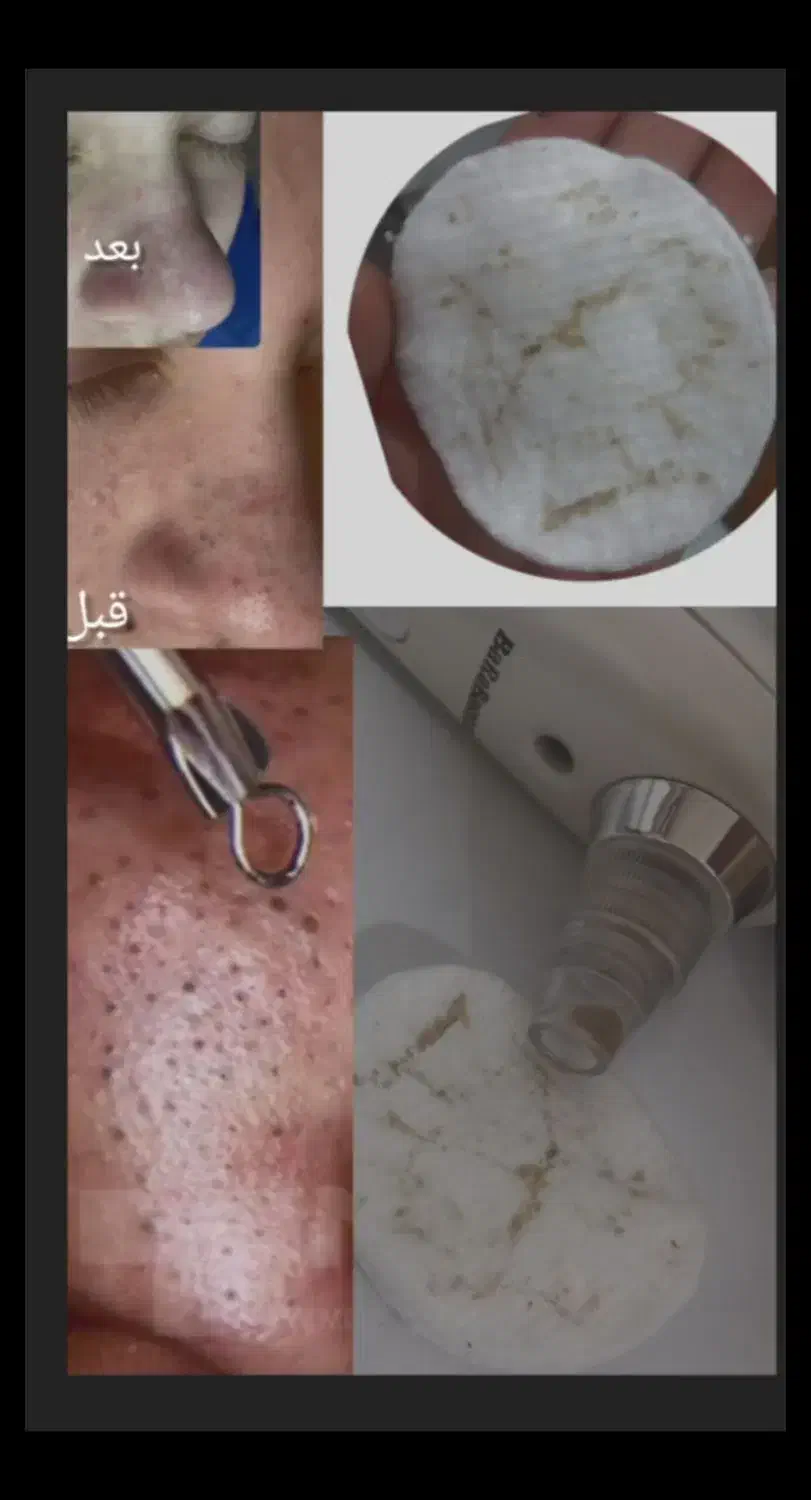 فیشیال کلاسیک|خدمات آرایشگری و زیبایی|دهدشت, |دیوار