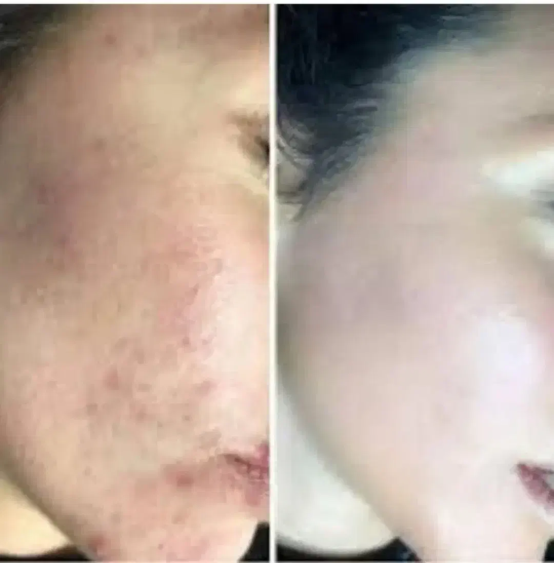 فرمول کرم صورت و دست پاه|ماشین‌آلات صنعتی|چابهار, |دیوار