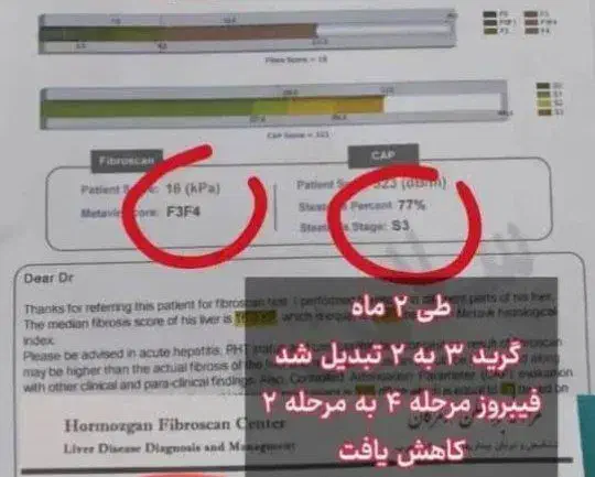 درمان تضمینی کبدجرب بامحصولات گیاهی شرکت کاژان|خوردنی و آشامیدنی|رباط‌کریم, شهرک صنعتی نصیرآباد|دیوار