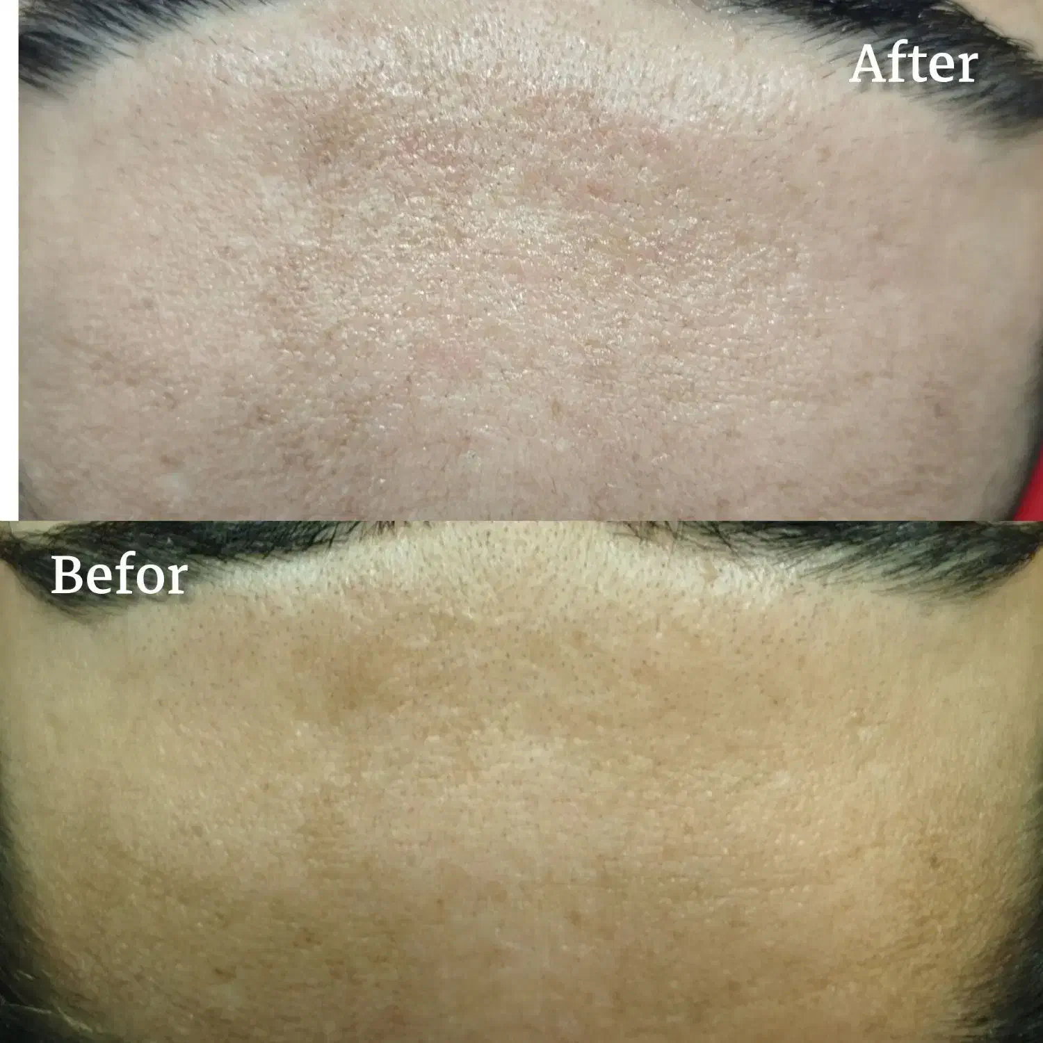 فیشال صورت ،درمان مو ،تزریق ژل صورت|خدمات آرایشگری و زیبایی|کارون, |دیوار