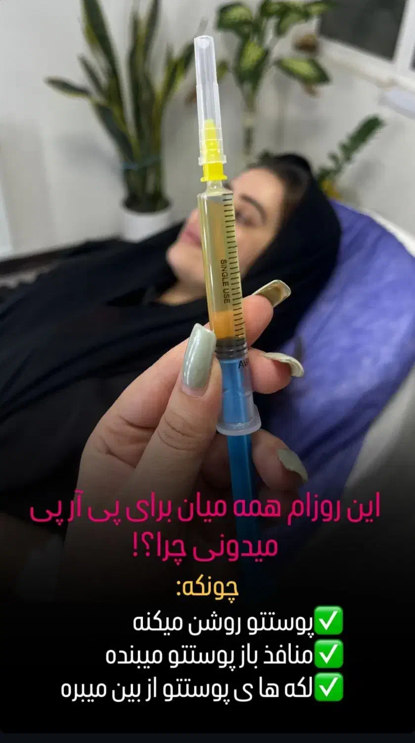 پی آر پی و مزوتراپی با بالاترین کیفیت|خدمات آرایشگری و زیبایی|اهواز, زیتون کارمندی|دیوار