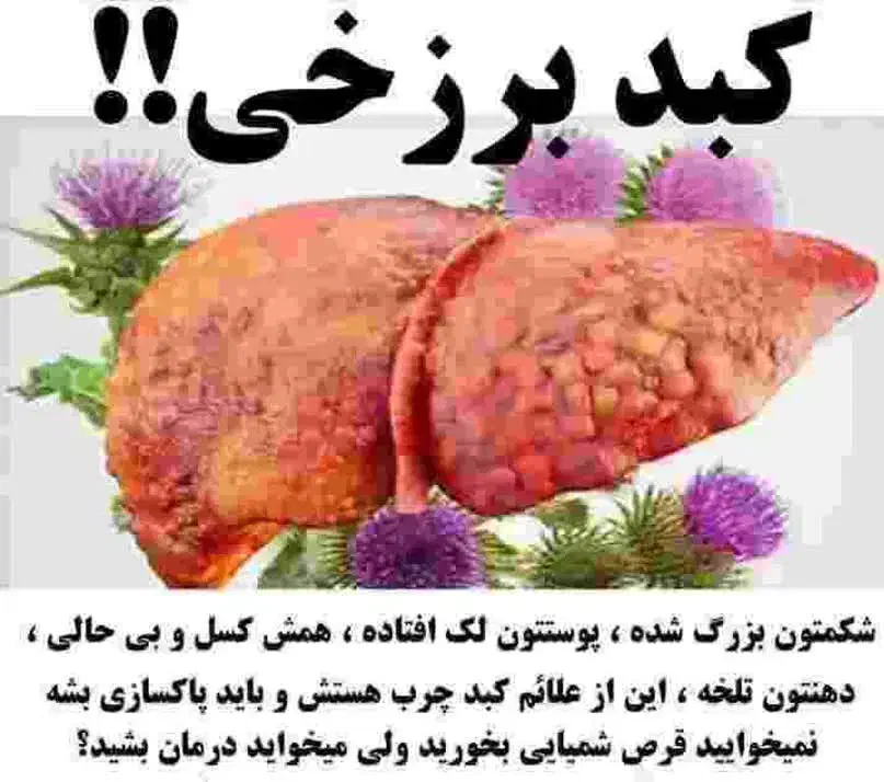 اصلاح مزاج، درمان مشکلات کبدی|آرایشی، بهداشتی، درمانی|اندیکا, |دیوار