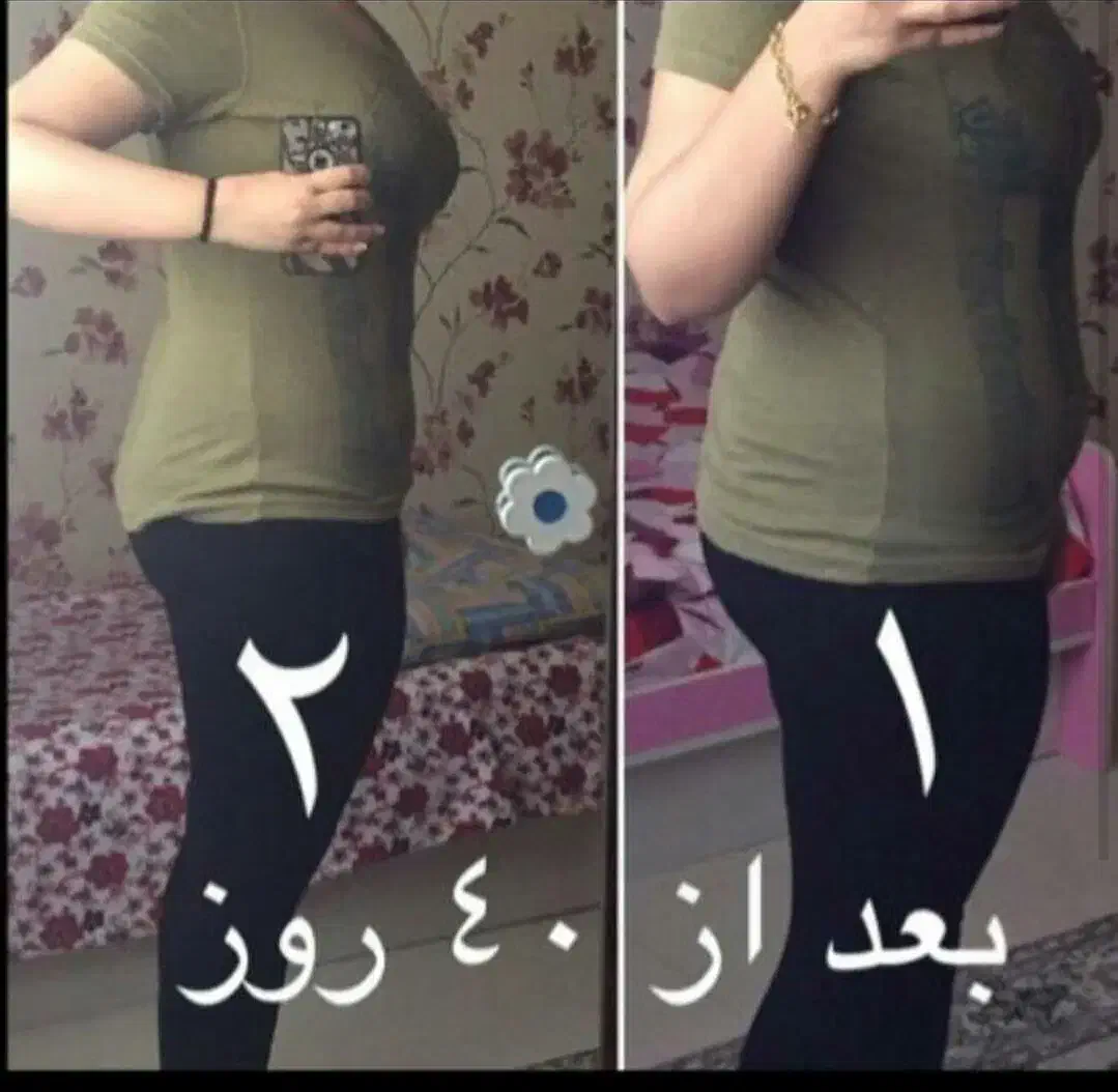 درمان چاقی و لاغری و ماساژ|آرایشی، بهداشتی، درمانی|تبریز, |دیوار