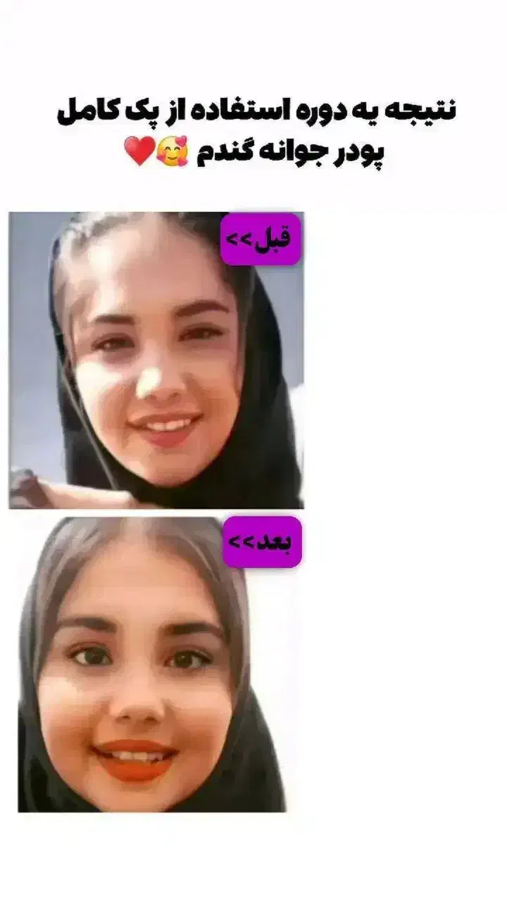 پودر جوانه گندم بین استار چاقی صورت100%تضمینی|خوردنی و آشامیدنی|اهواز, سپیدار|دیوار