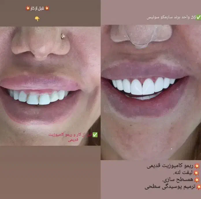 استخدام ویزیتور و بازاریاب کامپوزیت دندان|استخدام بازاریابی و فروش|یاسوج, |دیوار