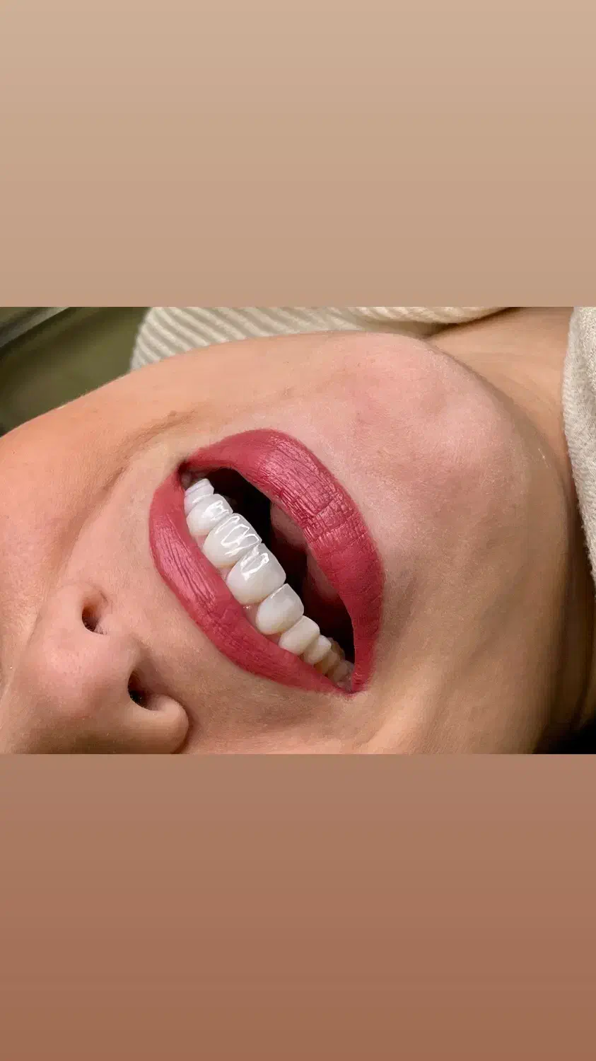 دندانپزشکی زیبایی جشنواره 50 درصدی با ضمانت|خدمات آرایشگری و زیبایی|تهران, نیاوران|دیوار