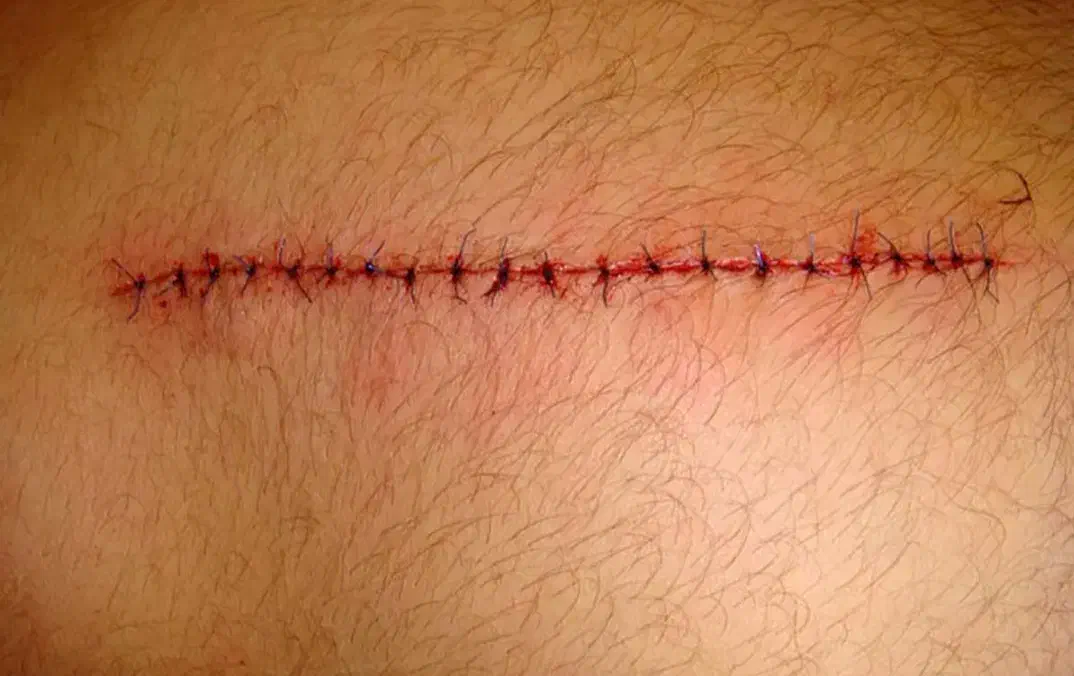 تزریقات و سرم تراپی و سونداژ در منزل توسط خانم|خدمات آرایشگری و زیبایی|تبریز, |دیوار