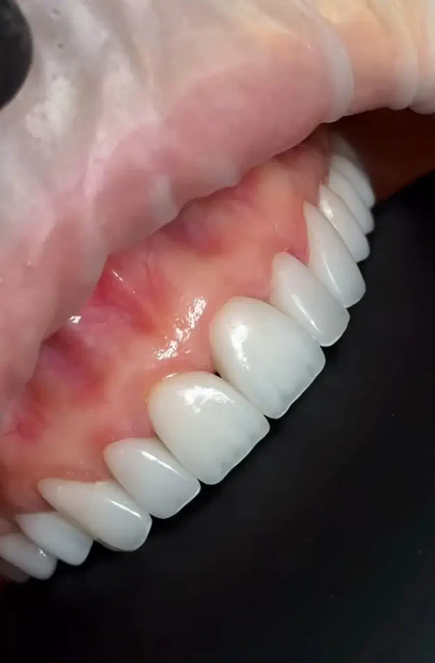 کامپوزیت ۴۰درصد تخفیف|خدمات آرایشگری و زیبایی|خرم‌آباد, |دیوار