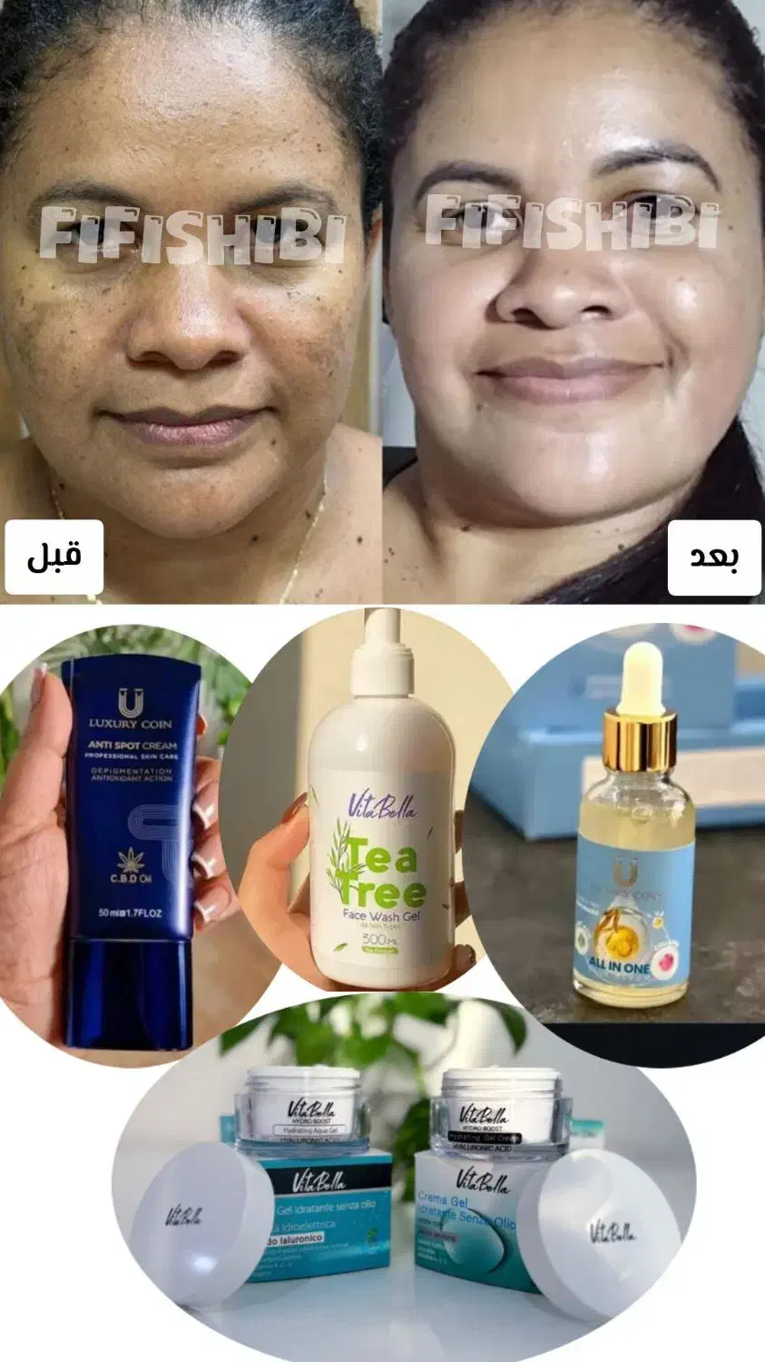 تنها نمایندگی سرم مغذی (همه کاره) لاکچری کوین|حراج|مشهد, فردوسی|دیوار