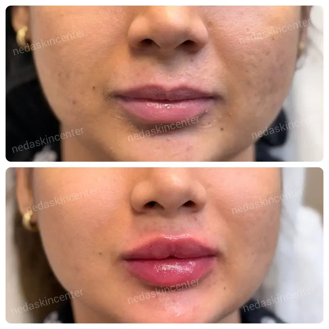 پوست مو زیبایی|خدمات آرایشگری و زیبایی|تهران, طیب|دیوار