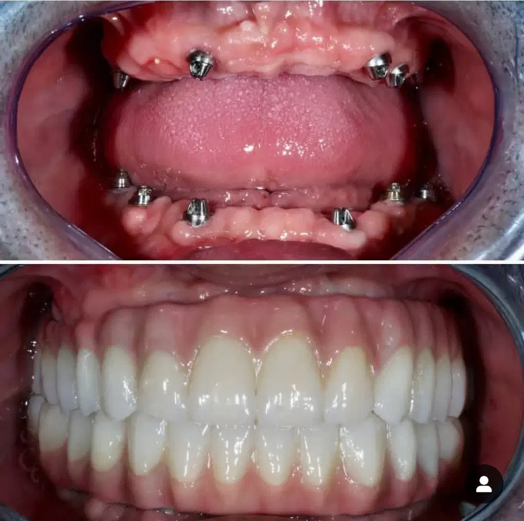 ثبت نام بیمه دندانپزشکی وکامپوزیت وزیبایی دندان|خدمات آرایشگری و زیبایی|گرگان, |دیوار