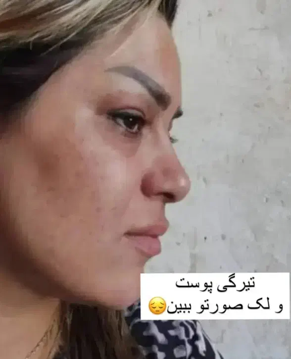 کرم معجزه شب|آرایشی، بهداشتی، درمانی|گنبد کاووس, |دیوار