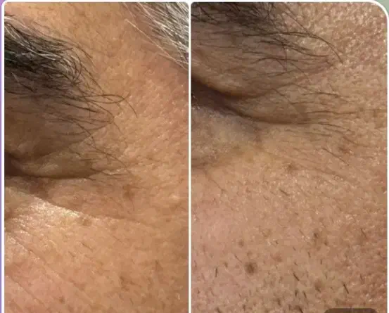 میکروکپسول کلاژن|آرایشی، بهداشتی، درمانی|زرند, |دیوار