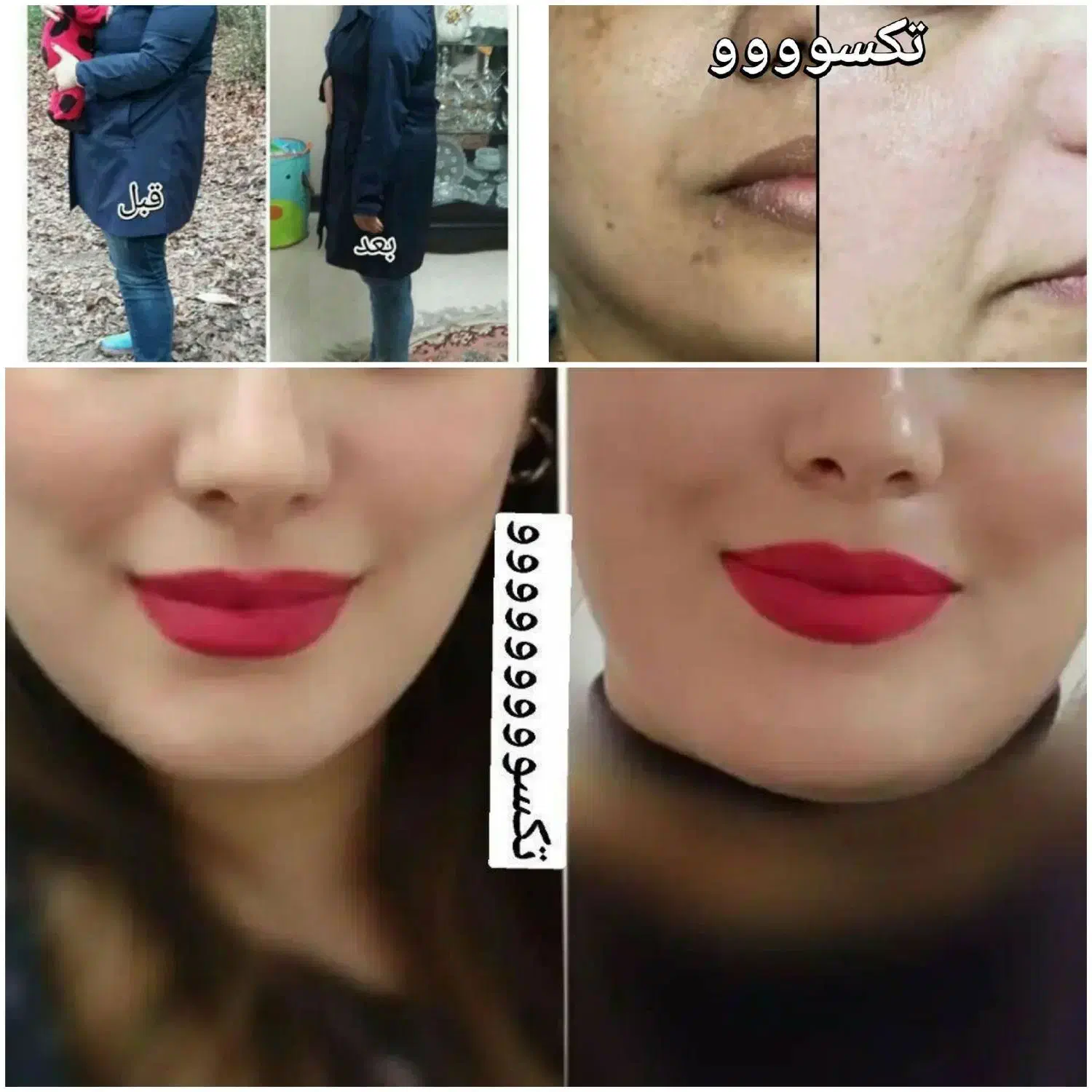 ناباروری ونازایی ، لاغری ، چاقی ، تیروئید، تیرگی|آرایشی، بهداشتی، درمانی|رشت, آزادگان|دیوار