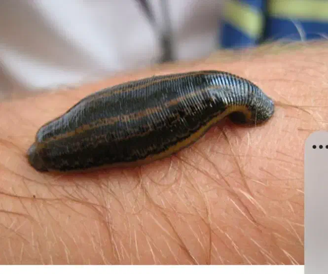 سلام حجامت زالودرمانی بادکش|خدمات آرایشگری و زیبایی|نیشابور, پنجراه|دیوار