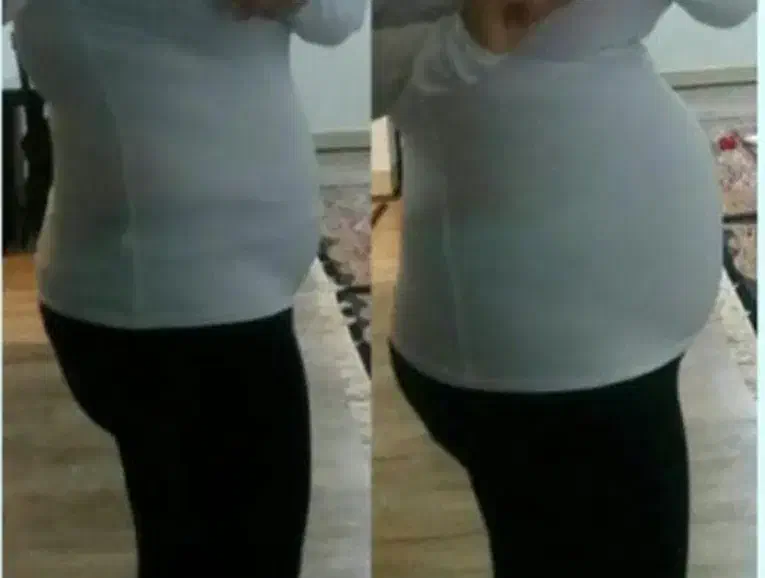 کبد چرب|فعالیت داوطلبانه|زابل, |دیوار