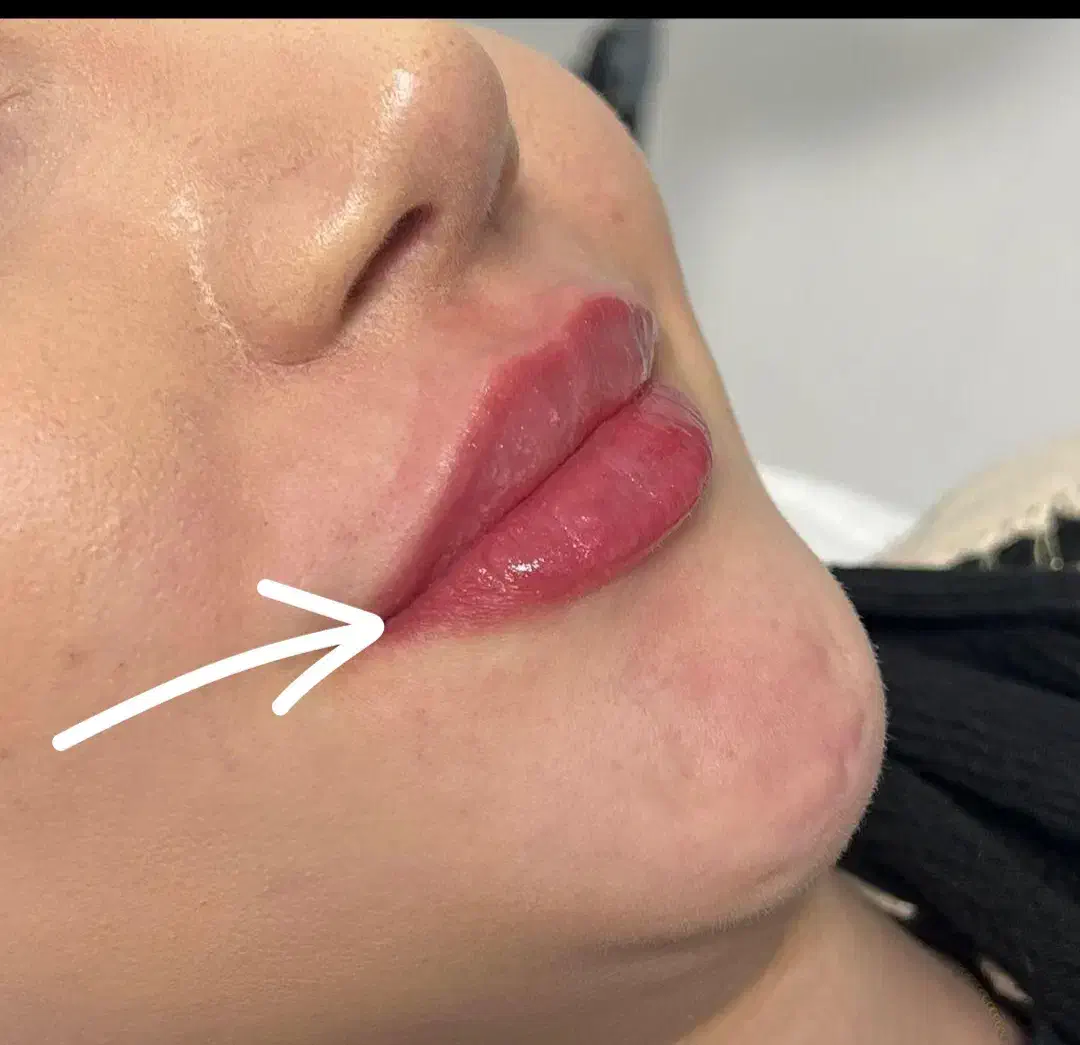 فروش و مدل ژل و بوتاکس|خدمات آرایشگری و زیبایی|اندیکا, |دیوار