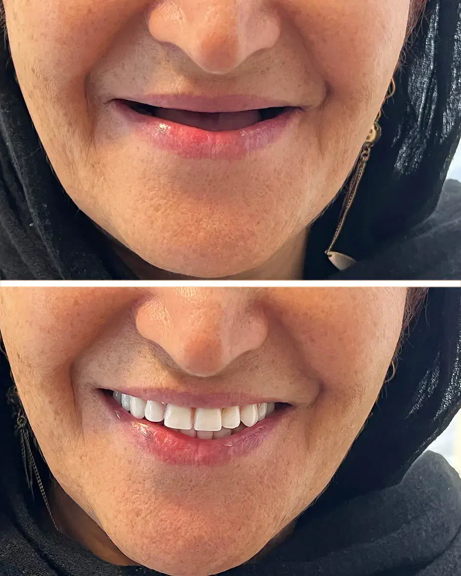 ساخت و تعمیر دندان مصنوعی/مواد آلمانی/نقد و اقساط|خدمات آرایشگری و زیبایی|چناران, |دیوار