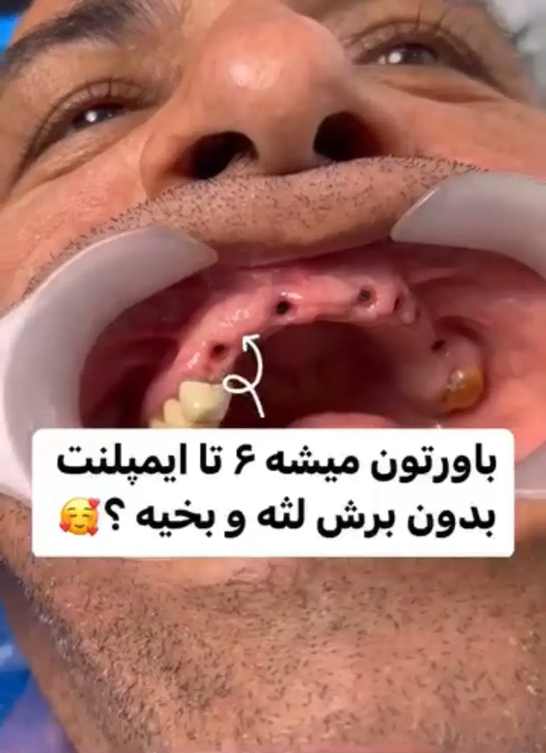 دندانپزشکی/ ایمپلنت دیجیتال با وام قرض الحسنه|خدمات آرایشگری و زیبایی|اصفهان, گلزار|دیوار