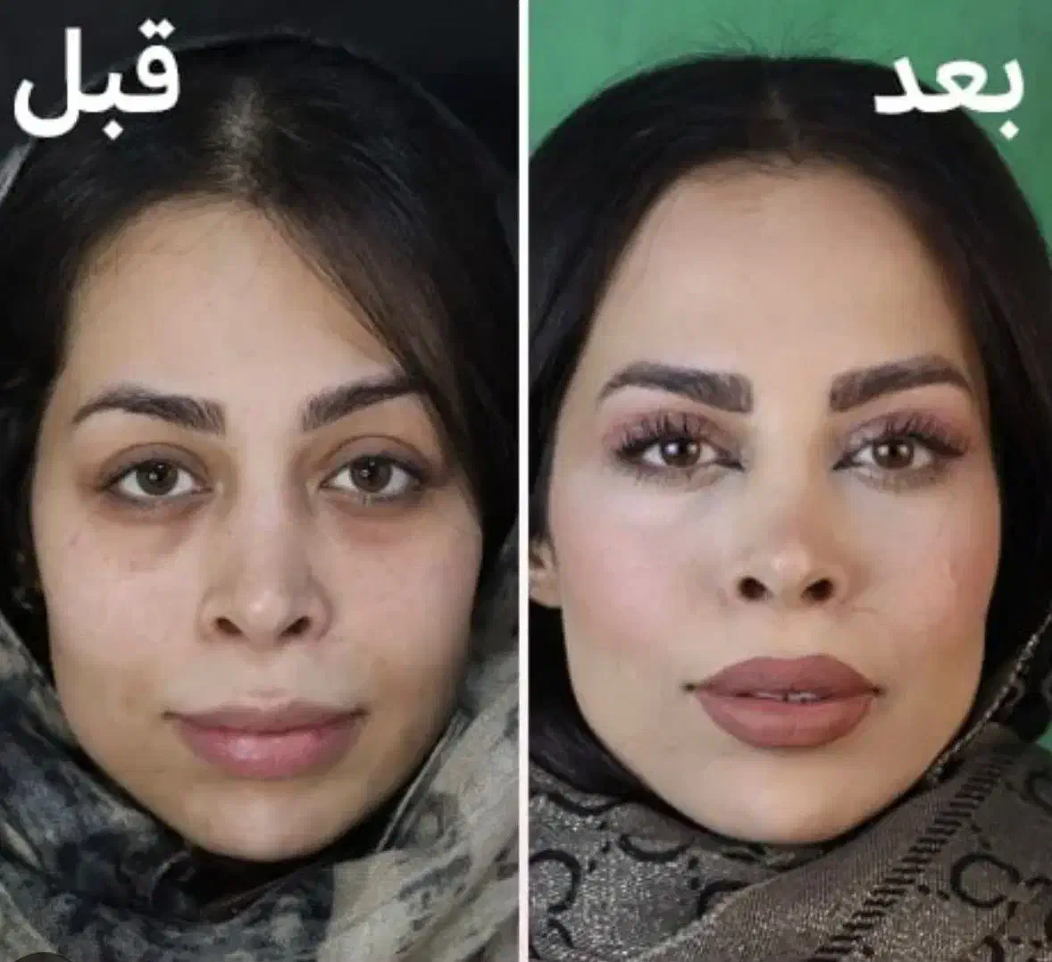 جشنواره پاییزه بلفاروپلاستی|خدمات آرایشگری و زیبایی|تهران, پاسداران|دیوار