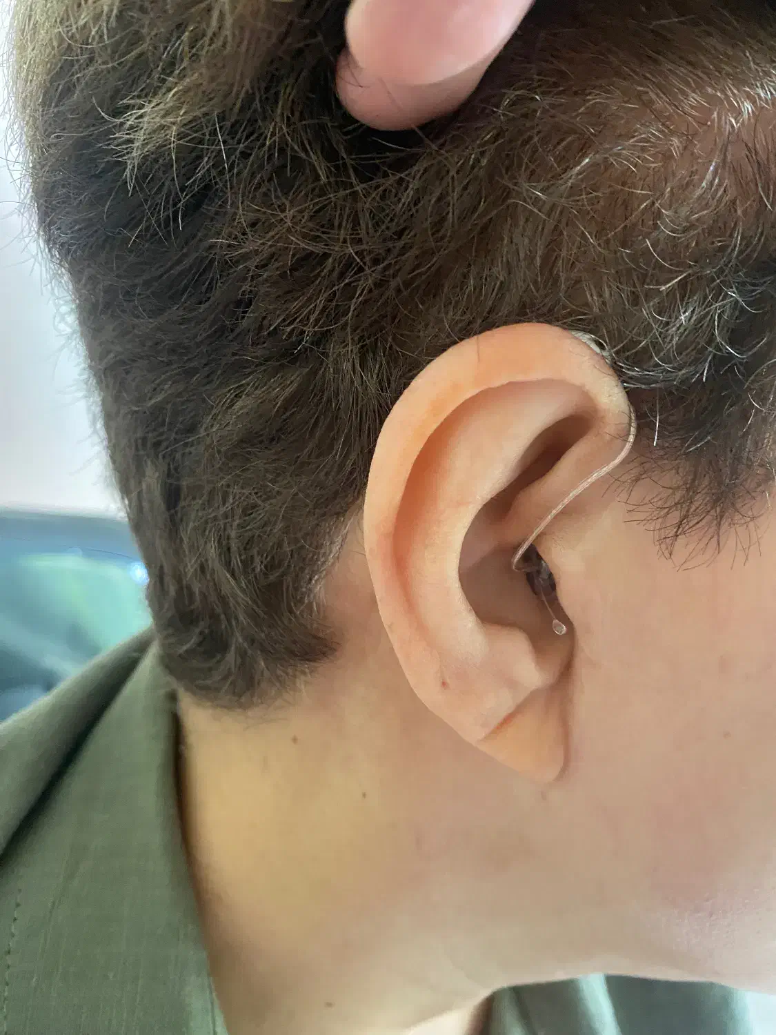 تجویز سمعک‌ فراهوشمند شارژی|پزشکی|تهران, نیاوران|دیوار