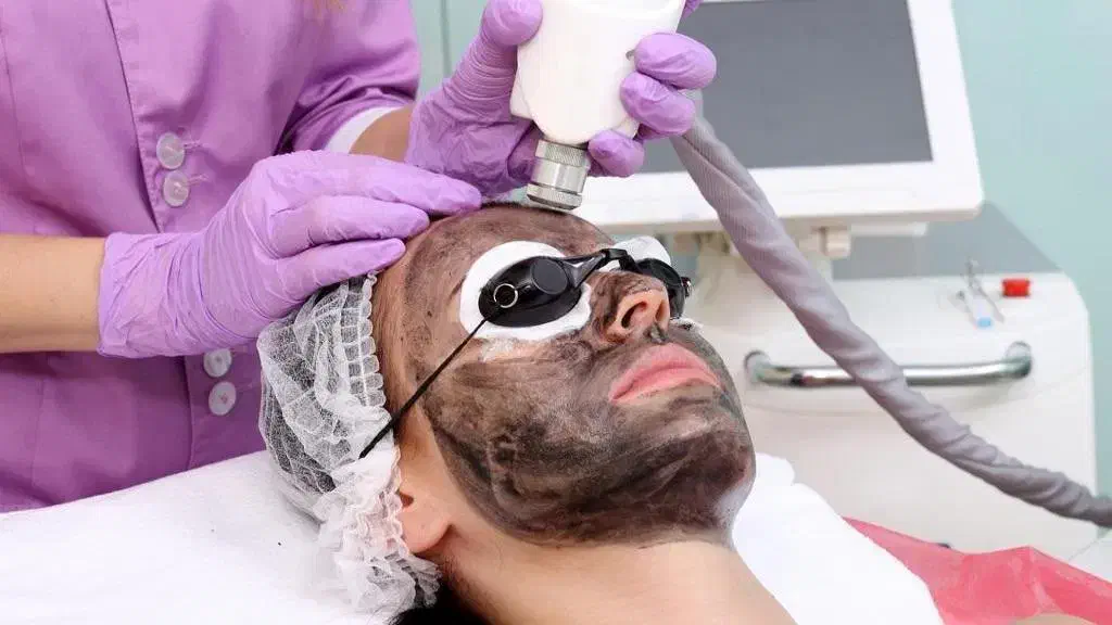 لیزر کربن سفید کننده و ضد لک و ریمو تتو تخفیف ۵۰٪|خدمات آرایشگری و زیبایی|دهدشت, |دیوار