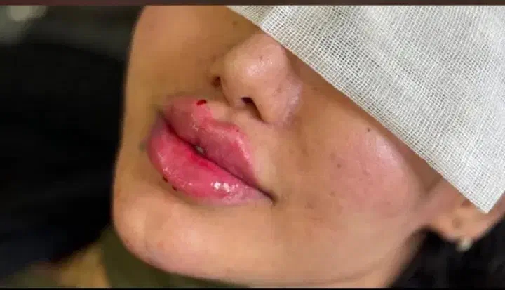 ژل و بوتاکس|خدمات آرایشگری و زیبایی|کارون, |دیوار