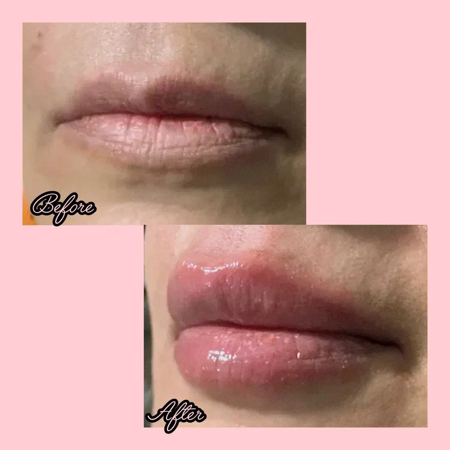 ژل بوتاکس|خدمات آرایشگری و زیبایی|سبزوار, امیر کبیر|دیوار