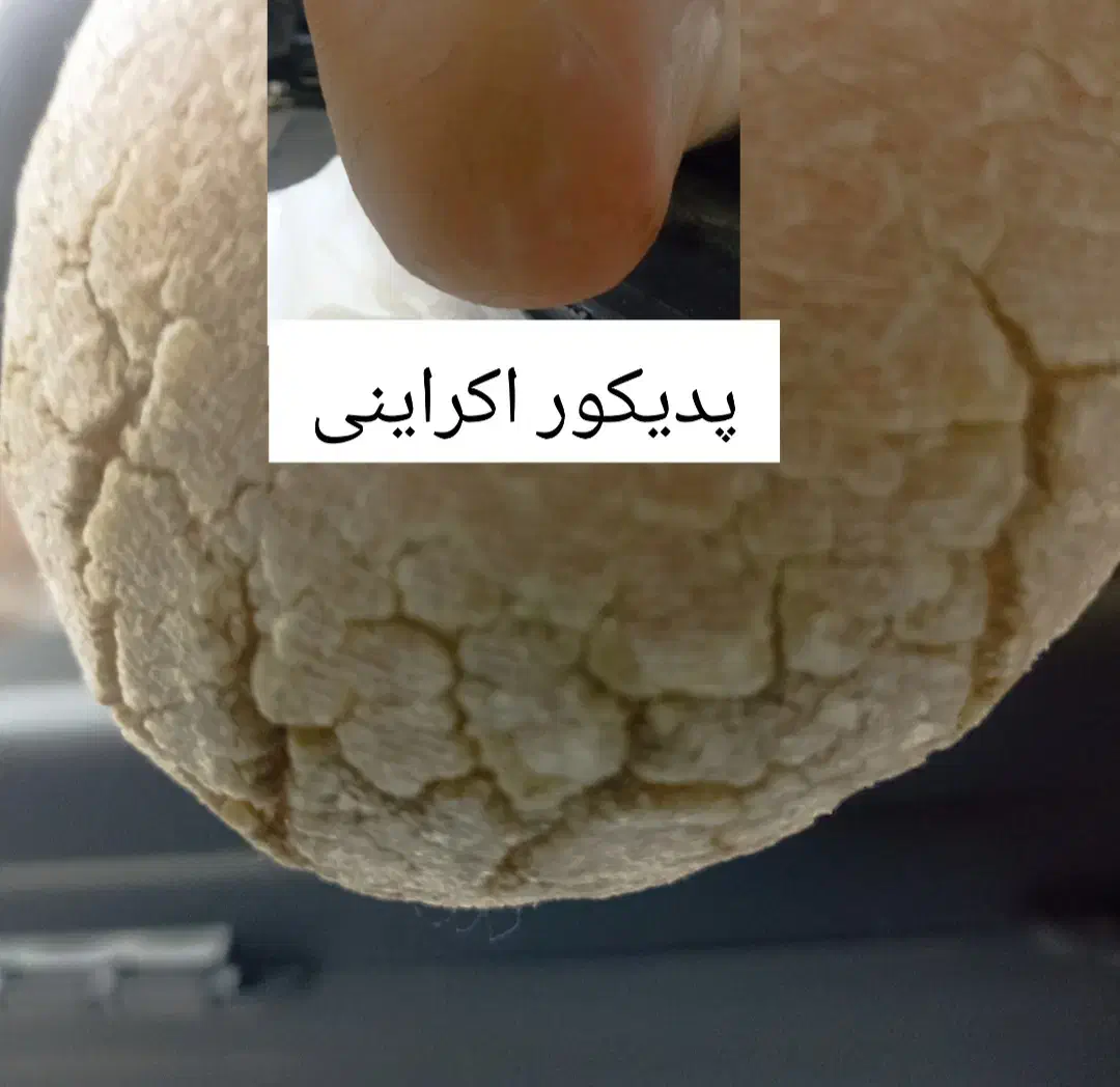 پدیکور درمانی آقایان و بانوان|خدمات آرایشگری و زیبایی|قم, دورشهر|دیوار