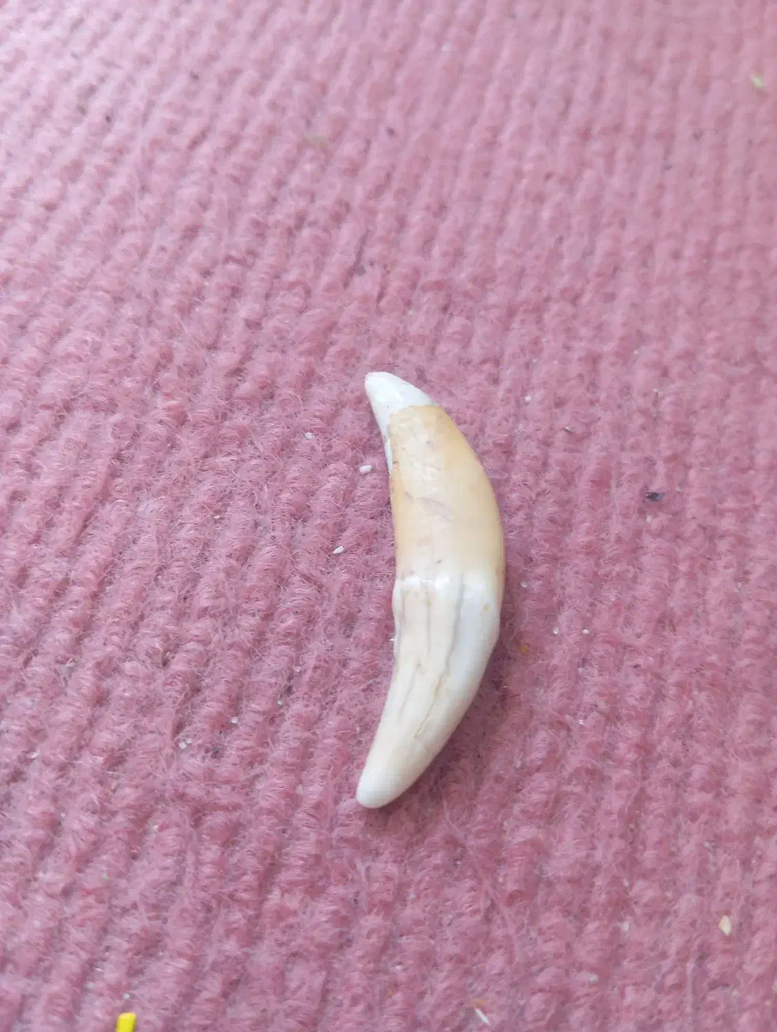 مهره دندان|کلکسیون اشیاء عتیقه|ایلام, |دیوار