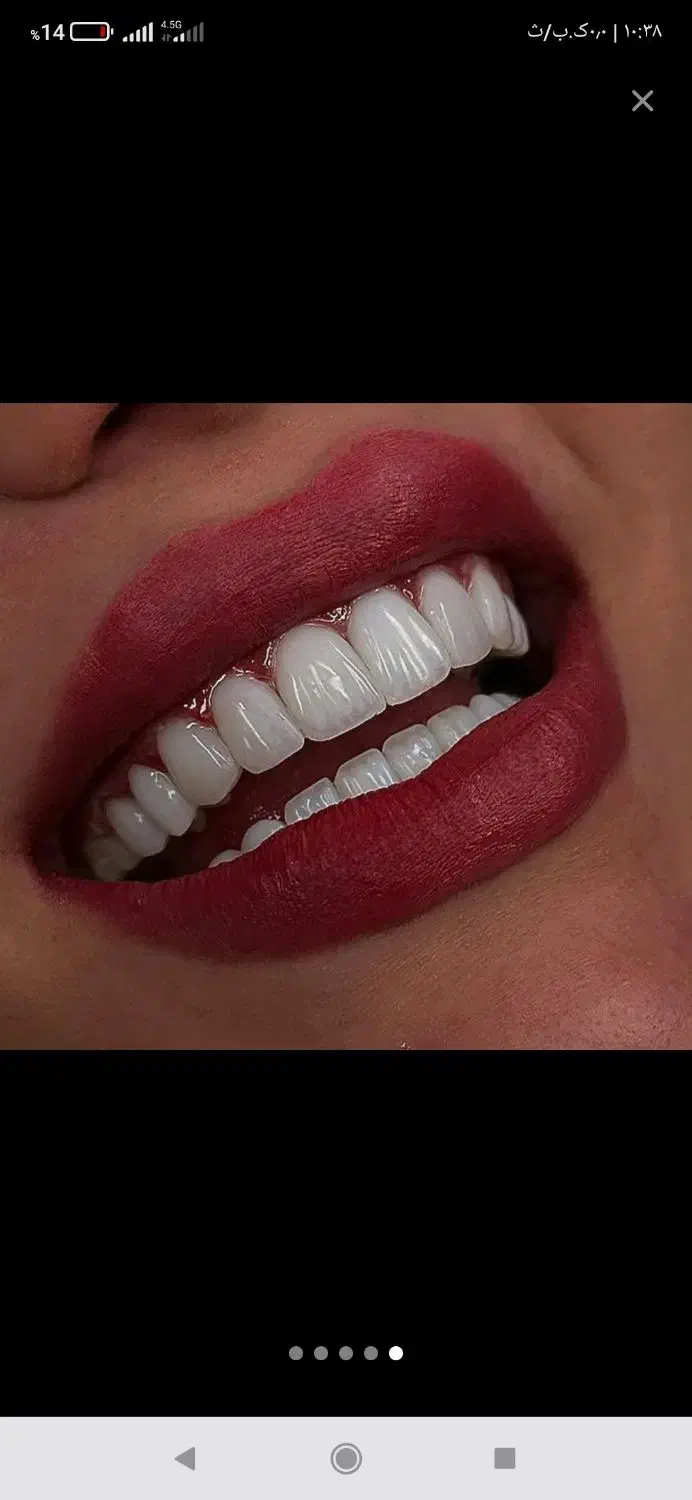 دندانپزشکی|خدمات آرایشگری و زیبایی|تهران, افسریه جنوبی|دیوار