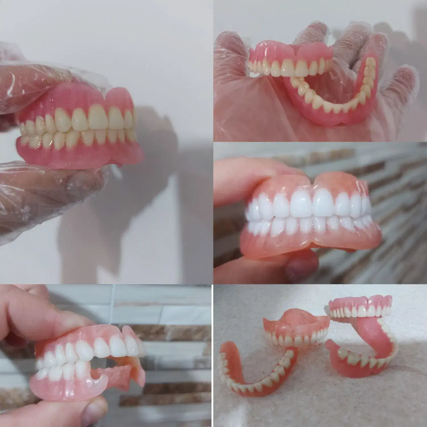 دندان متحرک مصنوعی بقیمت سنندج۶/۵ زرین آباد ایجرود|فعالیت داوطلبانه تحقیقاتی|زنجان, |دیوار