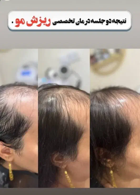 آموزش اسکالپ سر با ضمانت یادگیری/شروع کلاس 1آذر|خدمات آموزشی|قم, سالاریه|دیوار