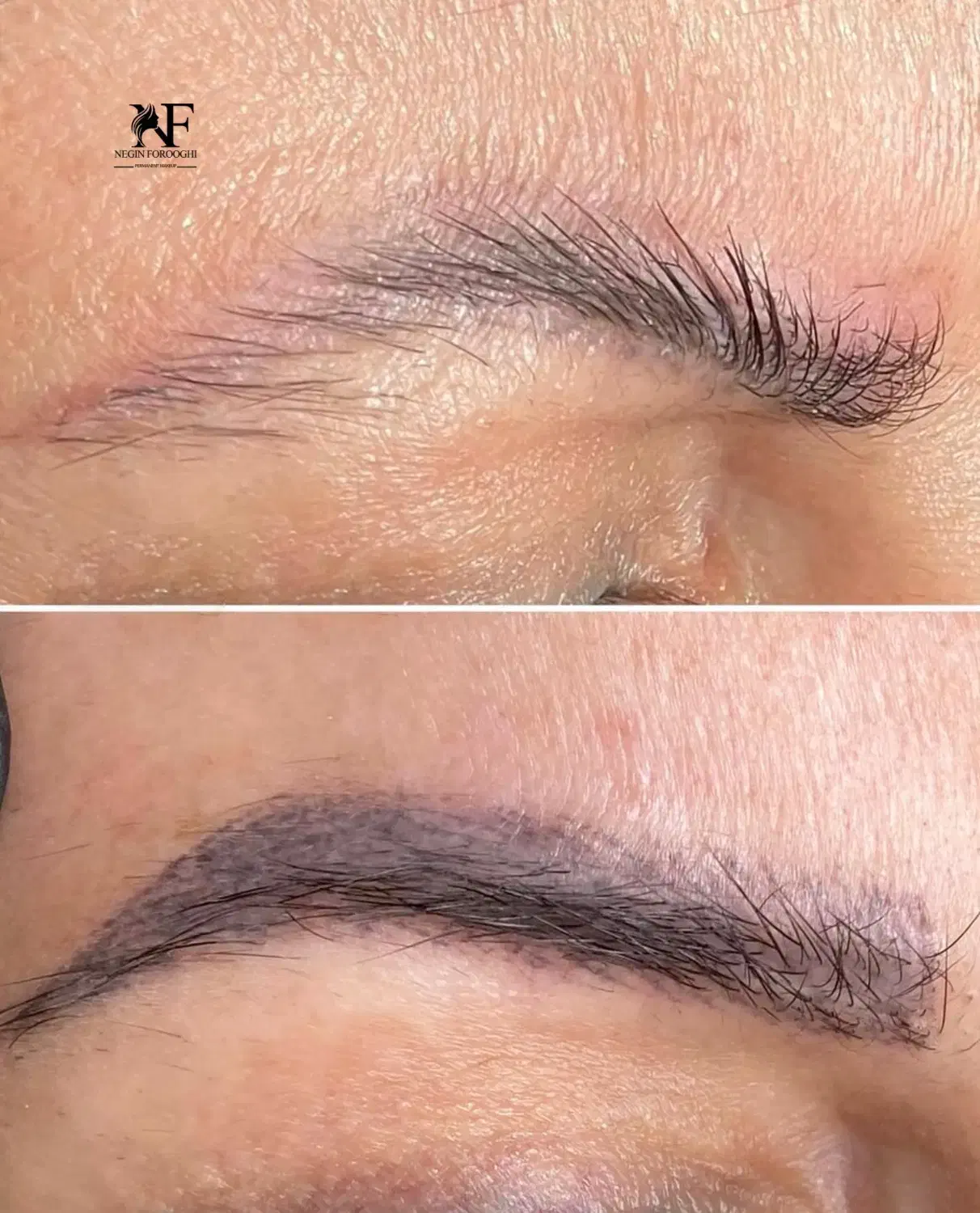 ریموو تک‌جلسه ای با رجووی اصل ومیکروبلیدینگ شیدینگ|خدمات آرایشگری و زیبایی|رشت, لاکانی|دیوار