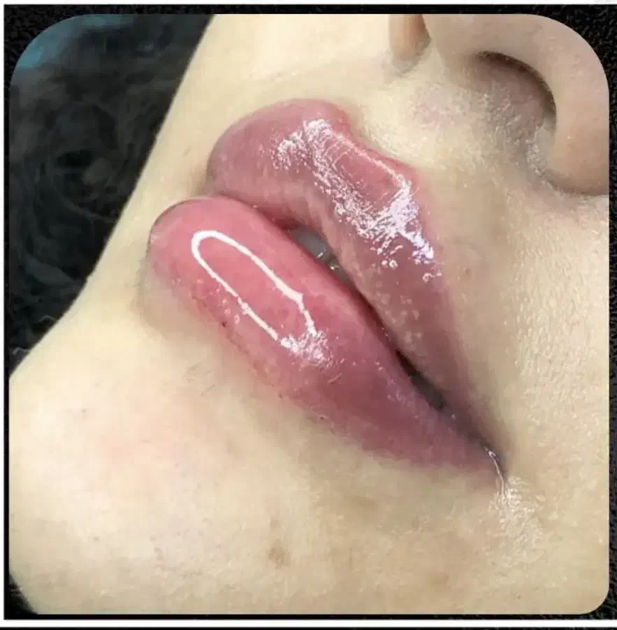 بوتاکس۵۹۰ فیلر۷۹۰لیزر فول بادی۷۵۰|خدمات آرایشگری و زیبایی|کیش, |دیوار