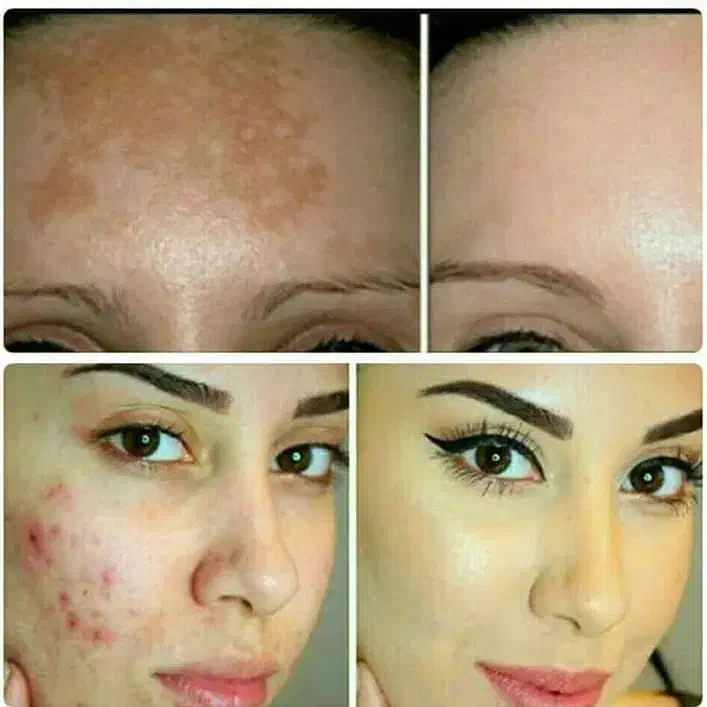 کرم معجزه آسا شب|آرایشی، بهداشتی، درمانی|ساری, |دیوار