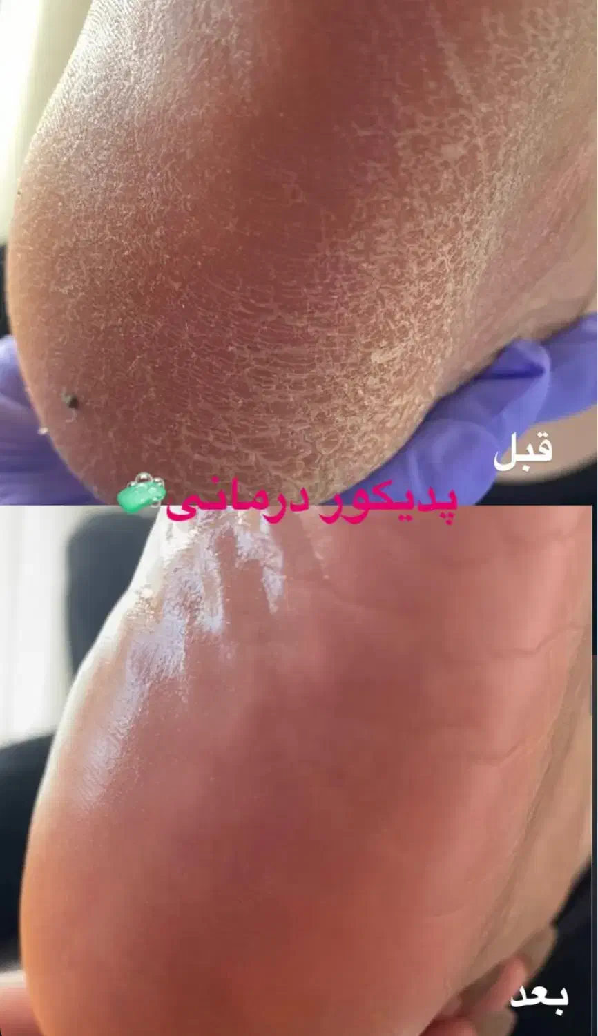 پدیکور با۲۰٪تخفیف|خدمات آرایشگری و زیبایی|ارومیه, |دیوار