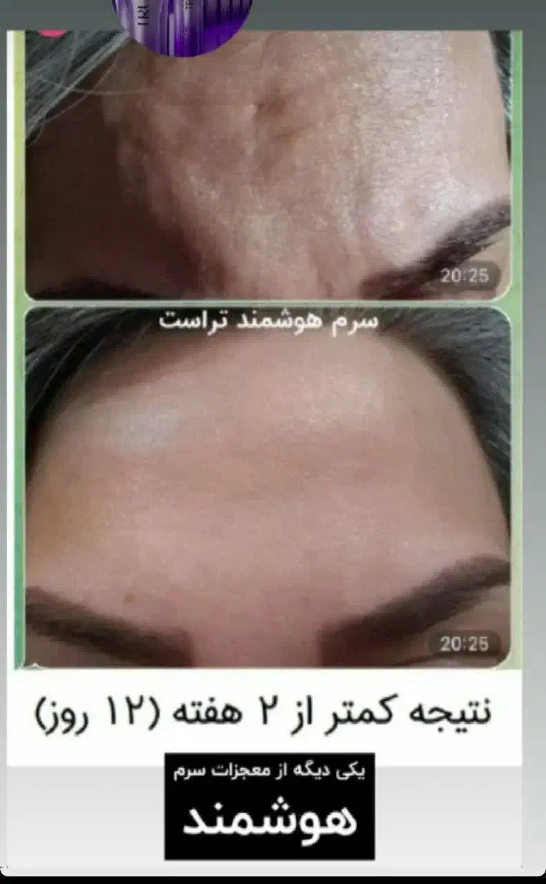 زیبایی و سلامتی پوست ومو|آرایشی، بهداشتی، درمانی|بابل, |دیوار