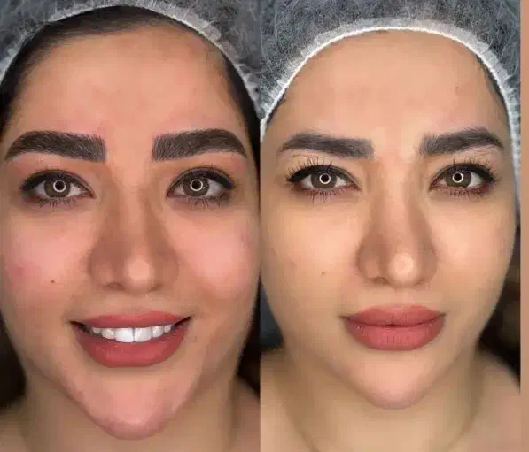 پیگمنتر حرفه ای ،اماده همکاری با سالن ها|استخدام درمانی، زیبایی، بهداشتی|برازجان, |دیوار