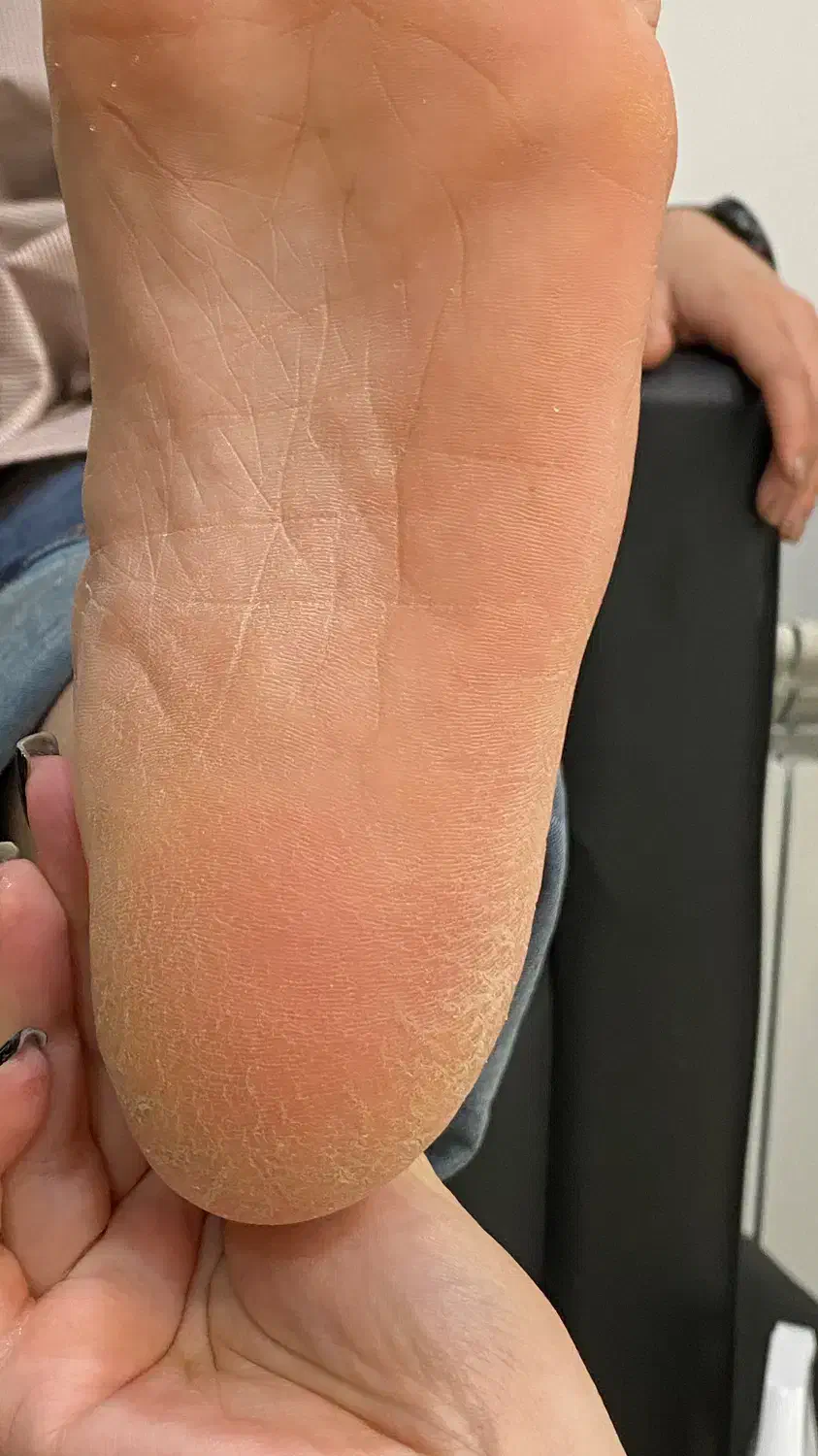 آموزش صفرتاصد کفسابی درمانی|خدمات آموزشی|رشت, گلزاران|دیوار