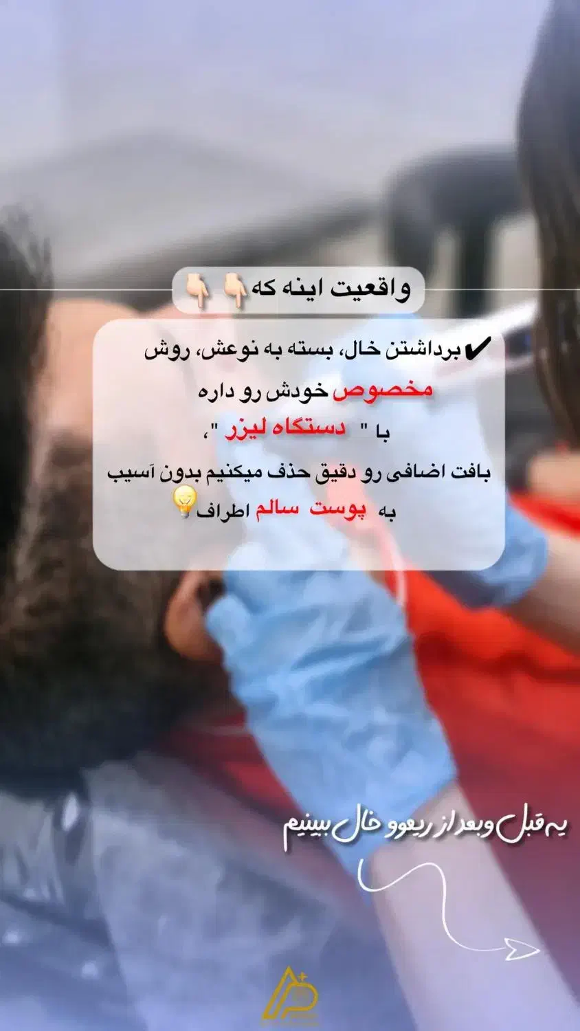 خال برداری/کک و مک/منگوله/ماه گرفتگی/روشن سازی|خدمات آرایشگری و زیبایی|شیراز, کوی زهرا|دیوار